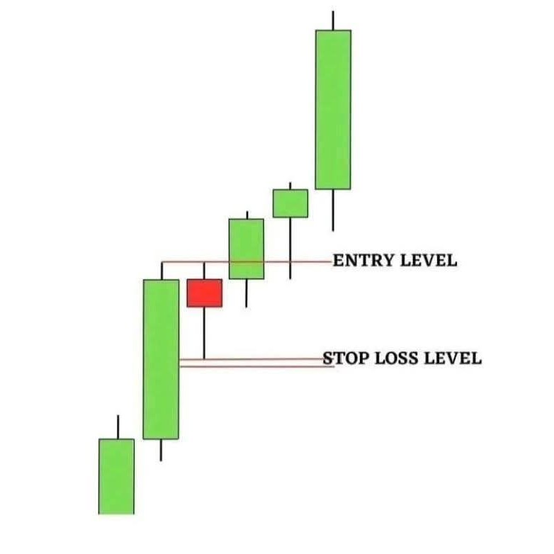 Forex Champion 🏆
