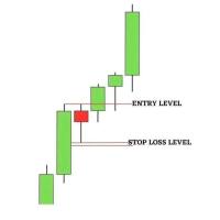 Forex Champion 🏆