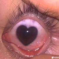 2739443