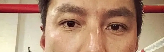 15年老反拥