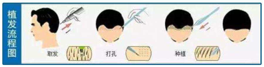 2.5亿人的烦恼,男神女神大佬都躲不过,却引爆了千亿市场