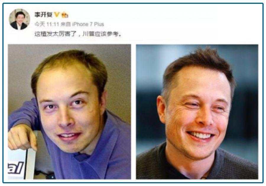 2.5亿人的烦恼,男神女神大佬都躲不过,却引爆了千亿市场