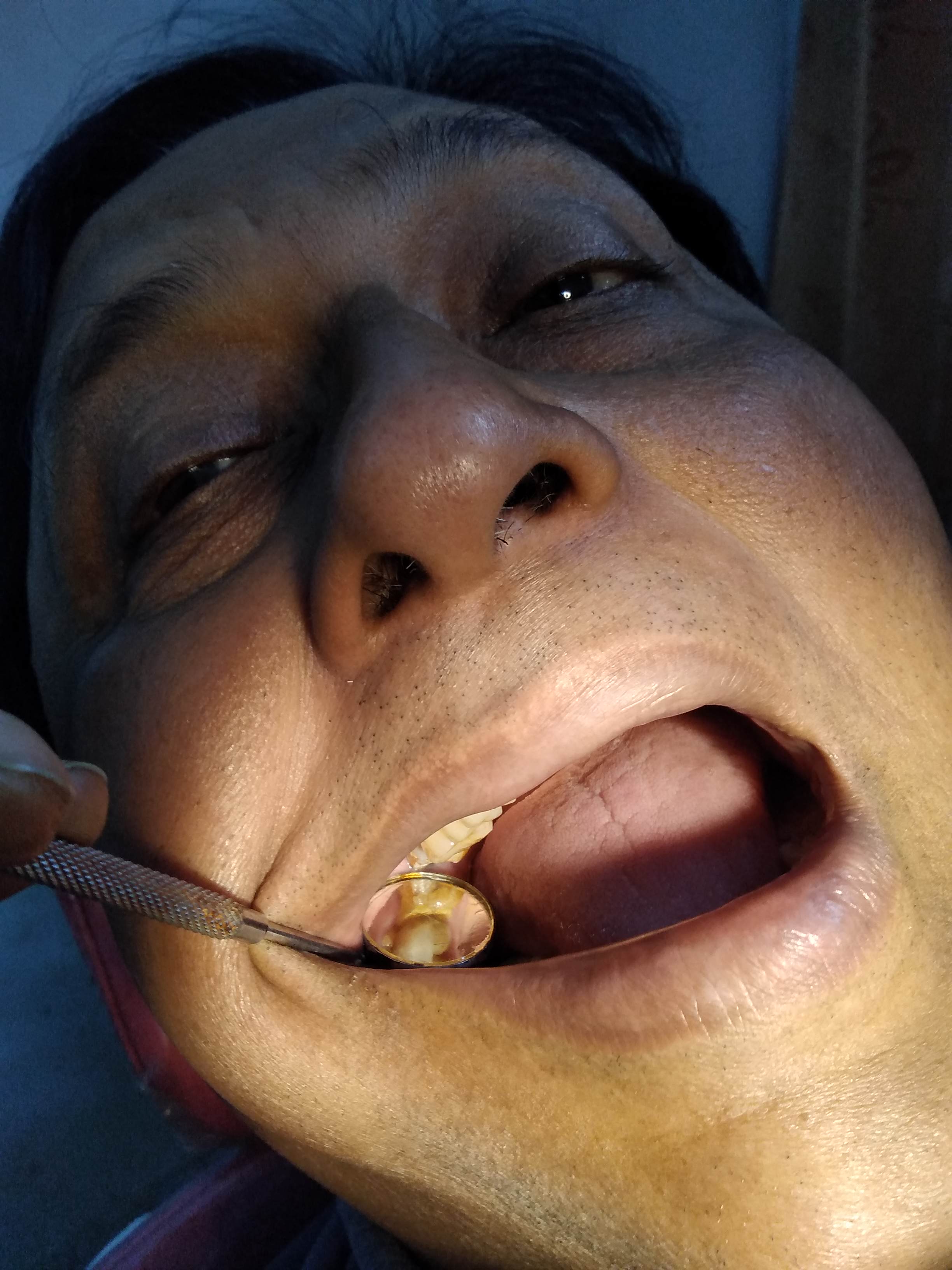feed-image-0