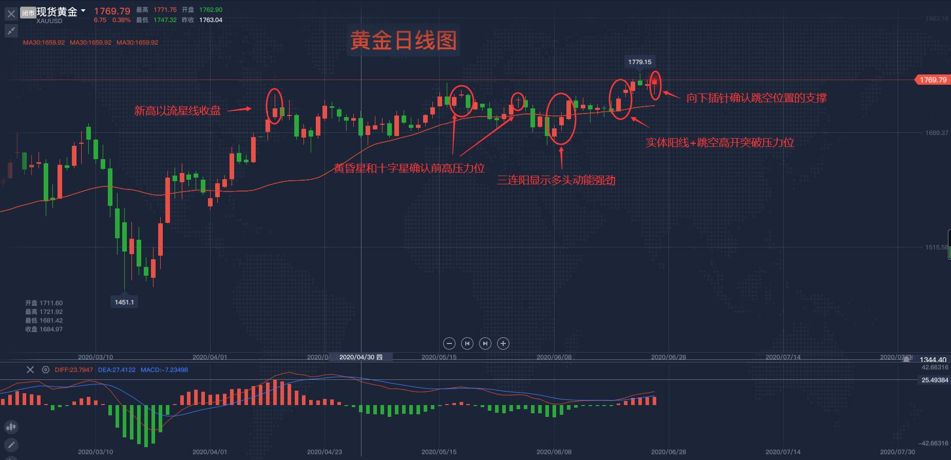 马坤振：支撑金价的因素