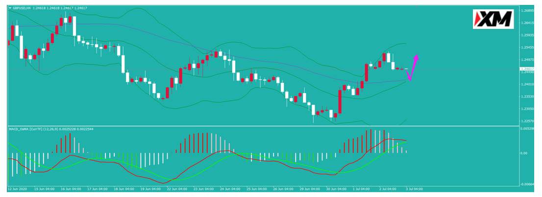 XM汇评 – 美国6月非农表现靓丽 非美震荡下行