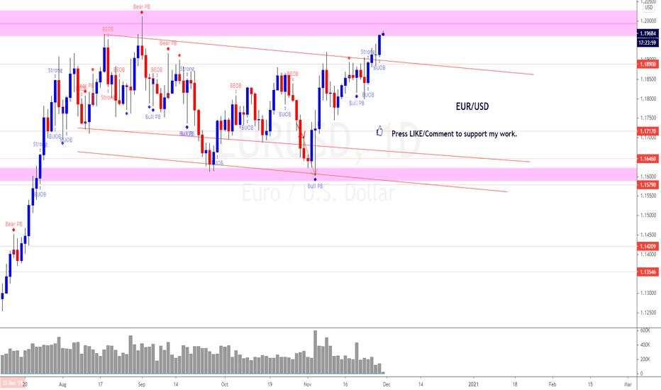 EUR/USD (Whatever can happen at any time can happen today!)