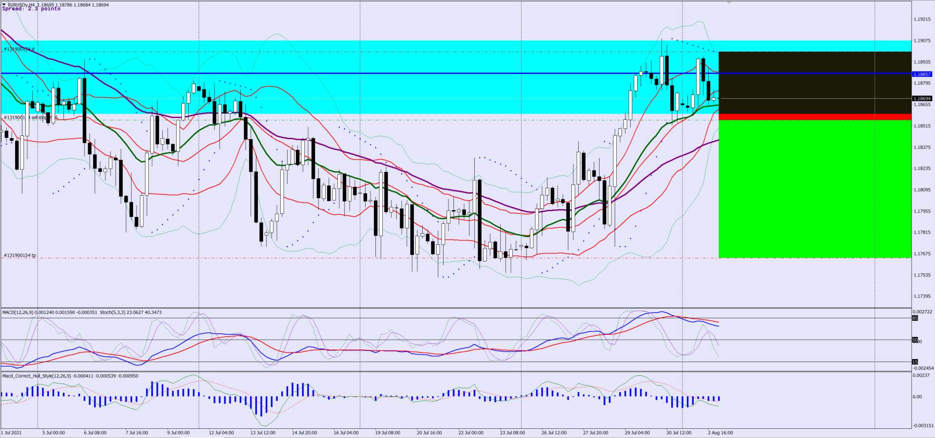 EURUSD Sell Trade Idea