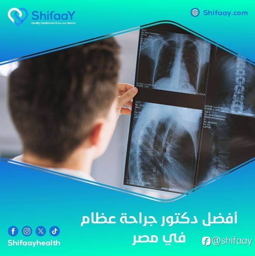 افضل دكتور جراحة عظام في مصر