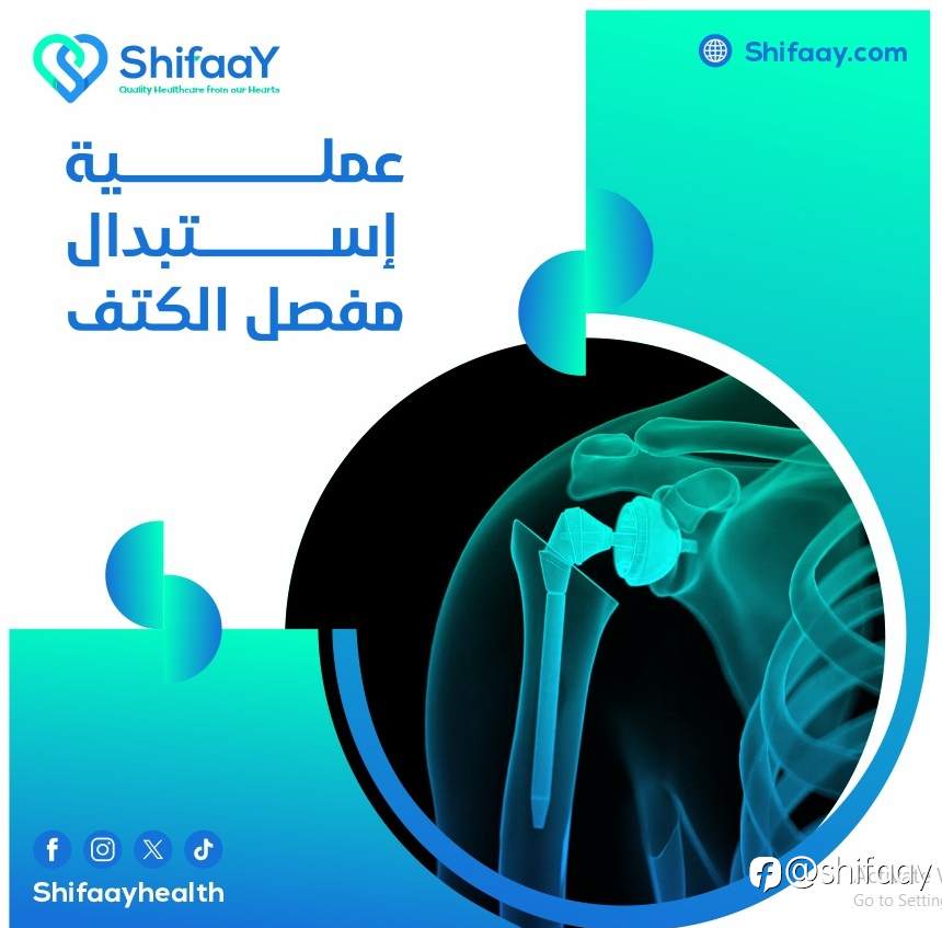 عملية استبدال مفصل الكتف