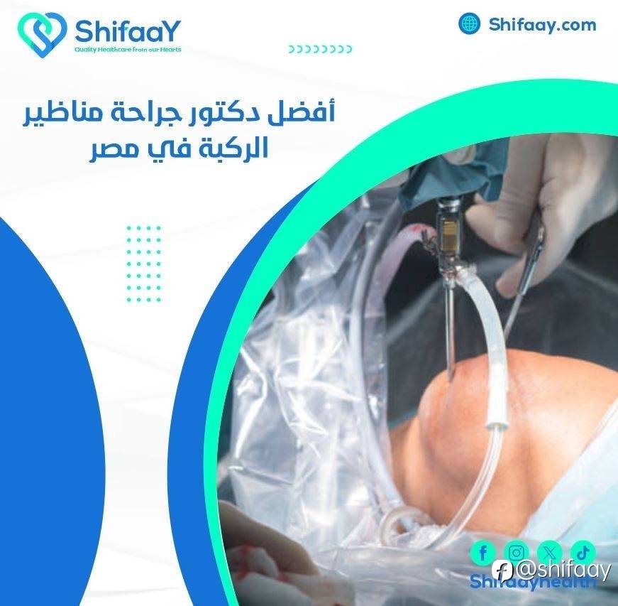 افضل دكتور جراحة مناظير الركبة في مصر