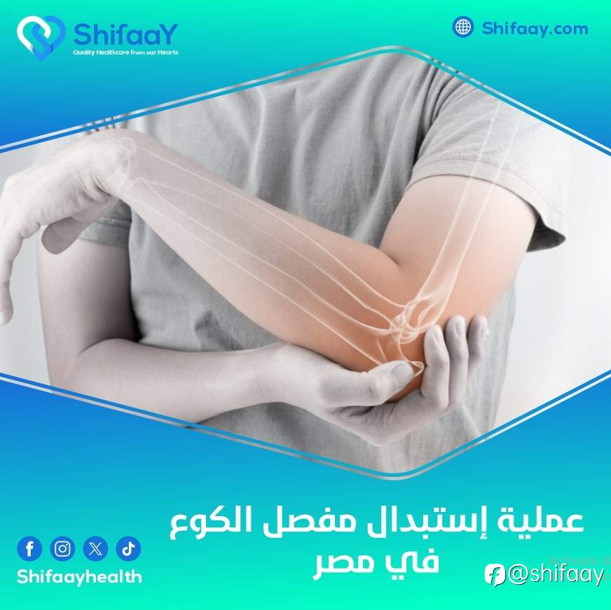 عملية استبدال مفصل الكوع في مصر