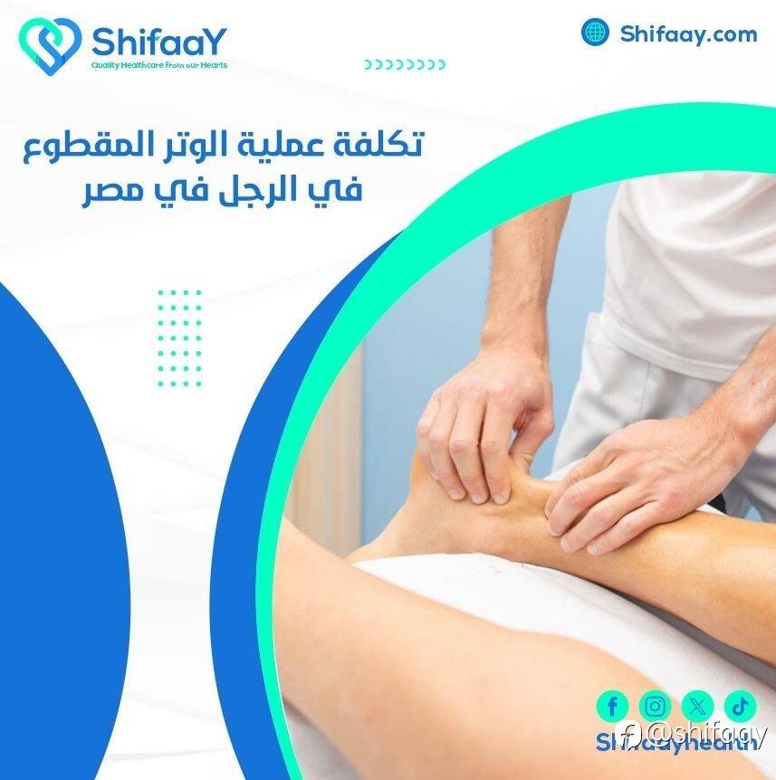 تكلفة عملية الوتر المقطوع في الرجل في مصر