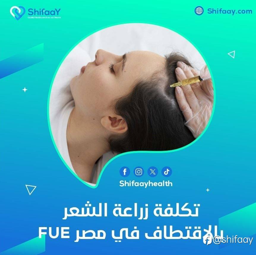 تكلفة زراعة الشعر بالاقتطاف في مصر FUE