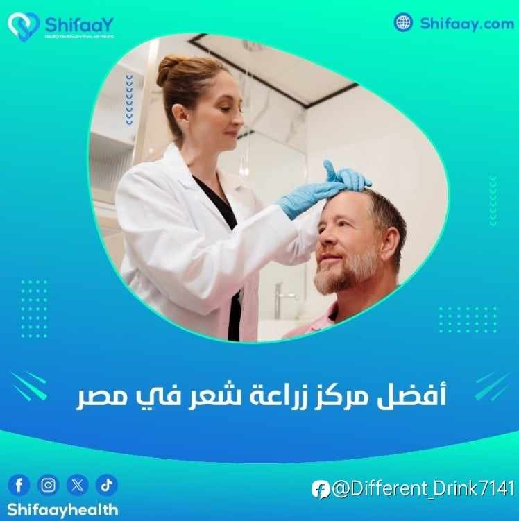 أفضل مركز زراعة شعر في مصر