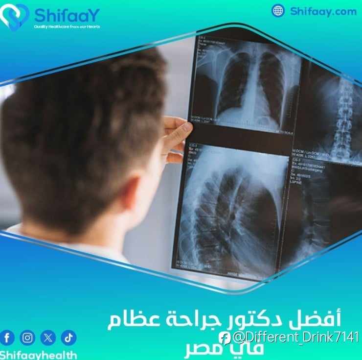 افضل دكتور جراحة عظام في مصر