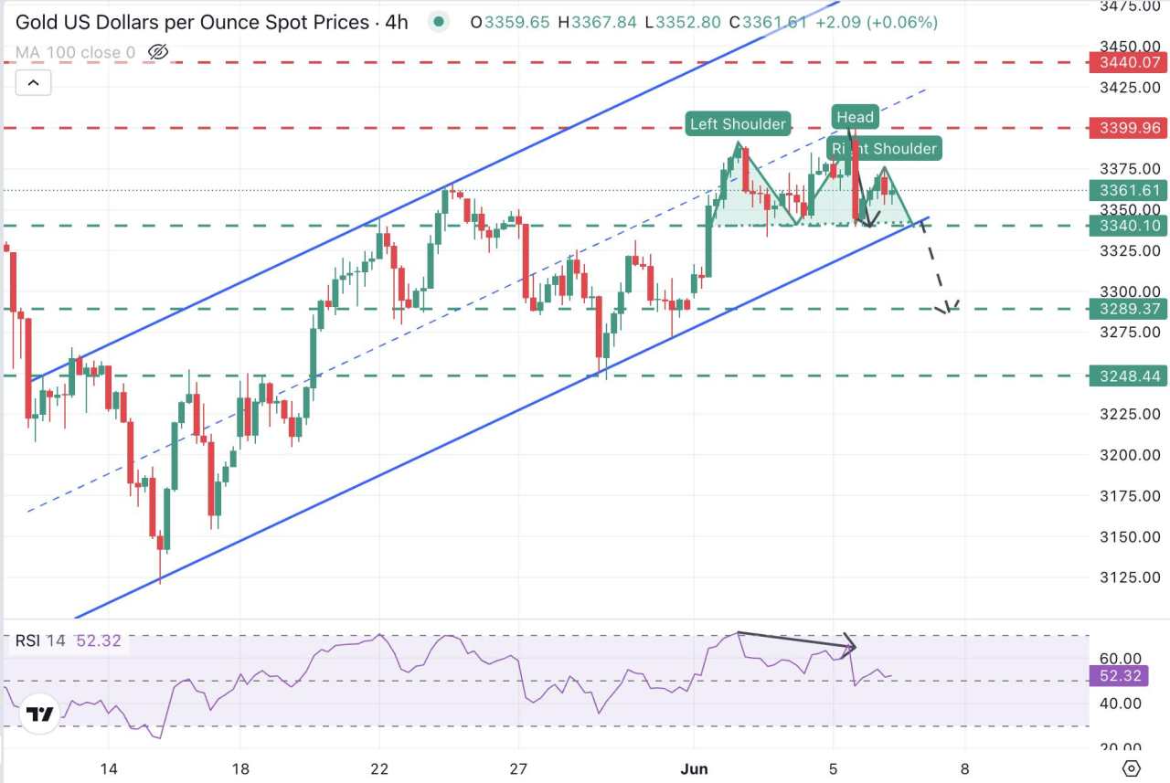 Gold Price Forecast: XAU/USD rally loses steam and approaches $3,340 support area