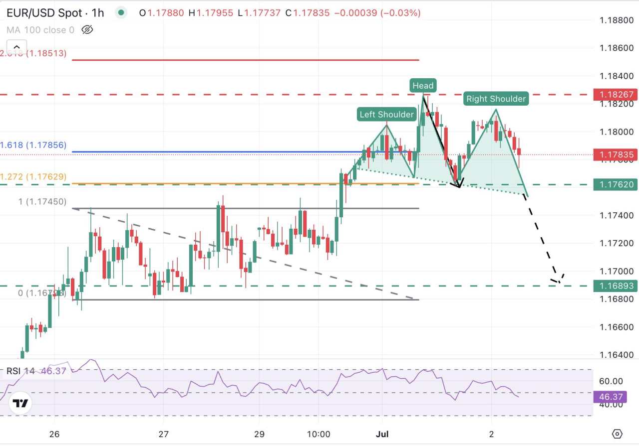 EUR/USD Pullback dari Tertinggi saat Investor Menunggu Data Ketenagakerjaan AS Selanjutnya
