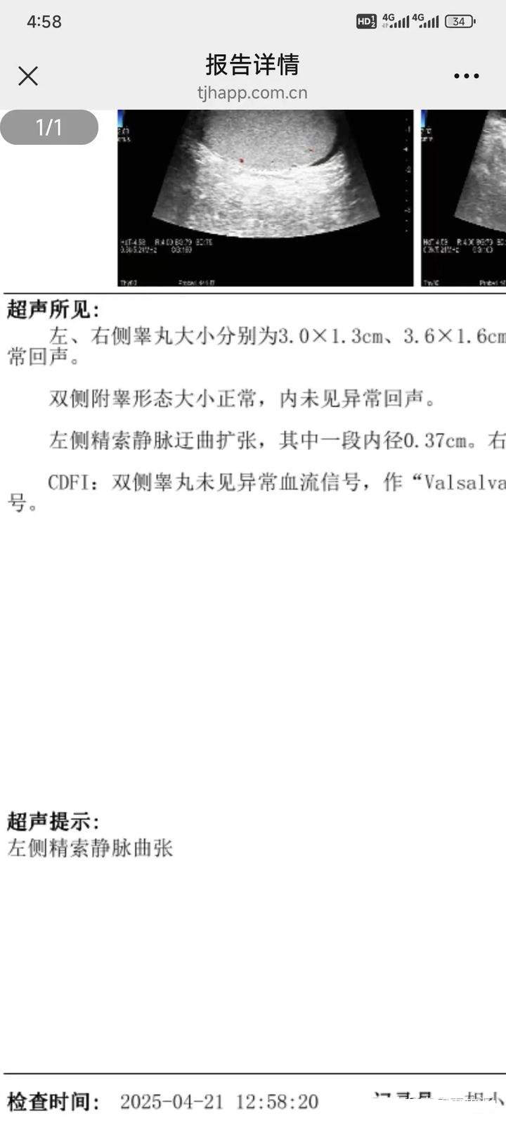 我长的又矮又丑，骨瘦如柴，阳痿还做过牢，赌博输了一百多万，劣迹斑斑。